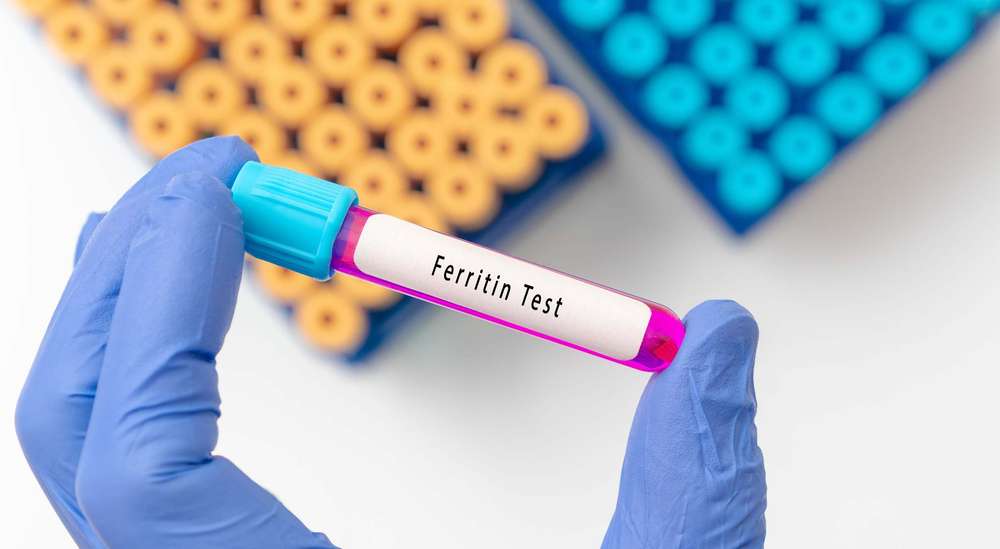 Blutprobe mit Ferritin
