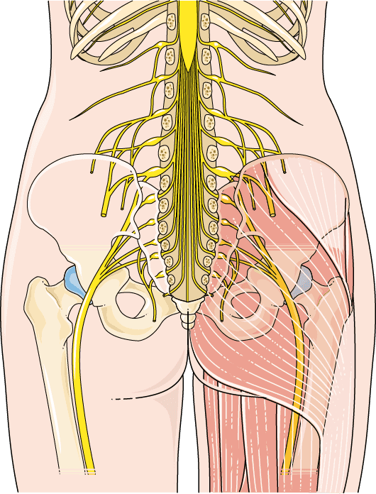 Grafische Darstellung des Ischiasplexus