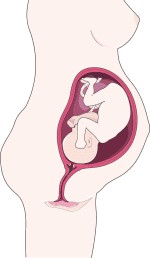 Ilustração gráfica de uma gravidez Ilustração gráfica de uma gravidez