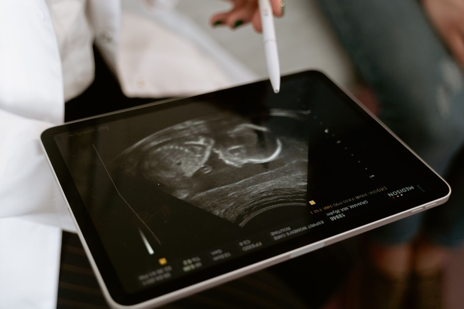 Ultraschallbild auf einem Tablet