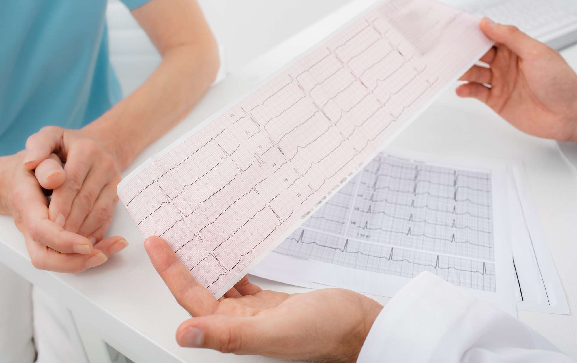 Grande plano de um eletrocardiograma