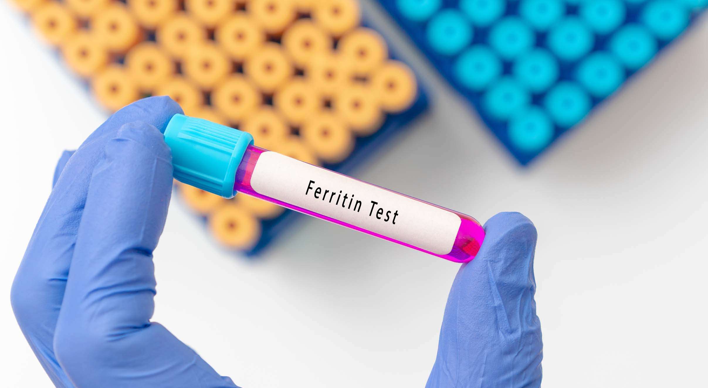 Échantillon de sang avec ferritine