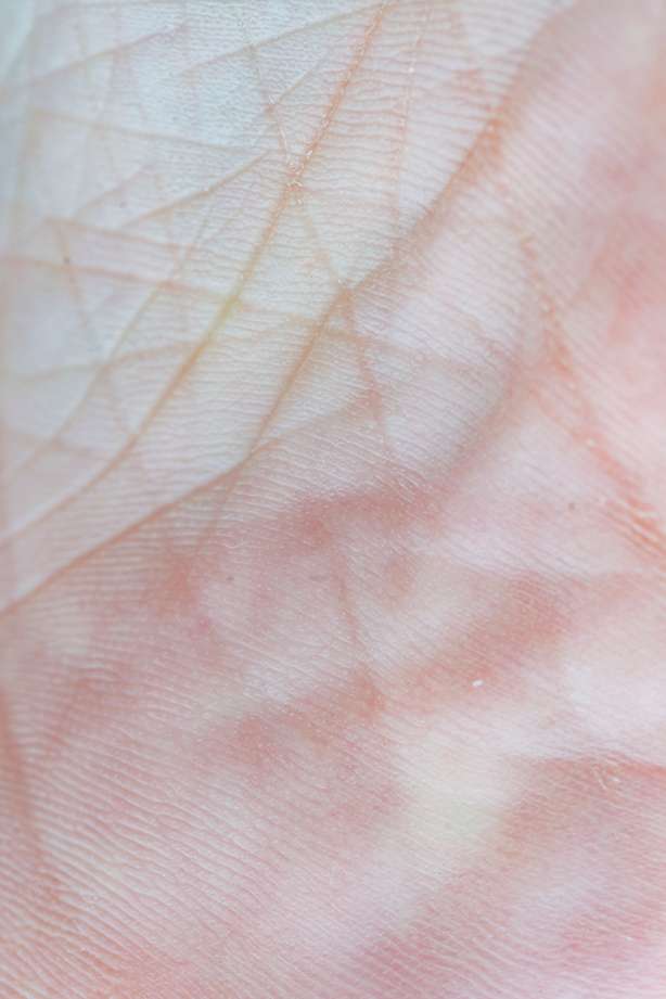 Retinol Warum empfehlen Dermatologen Retinol? Erfahren Sie mehr über seine Vorteile