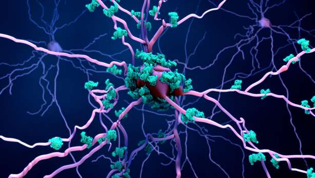Tod von Neuronen im Gehirn Tod Neuronen Gehirn