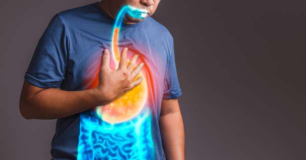 le reflux gastro-œsophagien reflux gastro-œsophagien : ALLEMAGNE