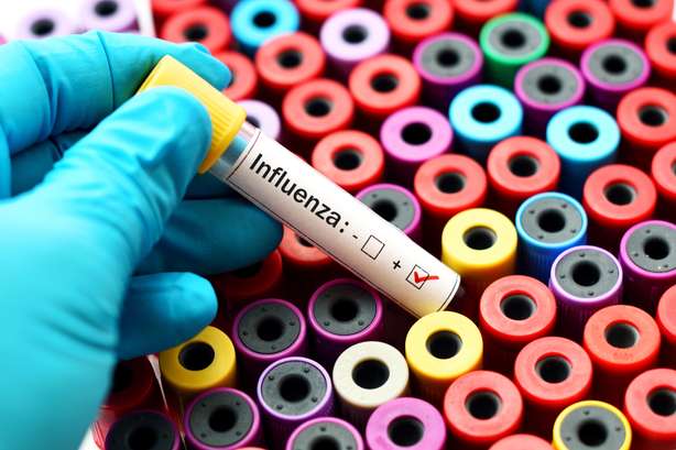 Eine positive Blutprobe mit dem Influenzavirus. Positive Blutprobe mit Influenzavirus