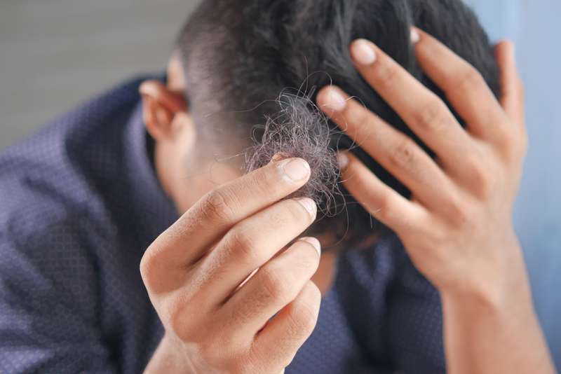 Mann hält ausgefallene Haare in der Hand
